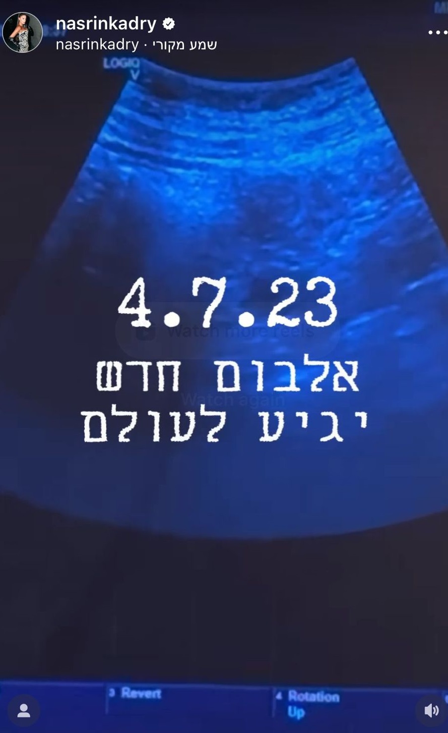 רשמו בפניכן את מועד הלידה המתוכנן. נסרין קדרי | צילום: אינסטגרם nasrinkadry@