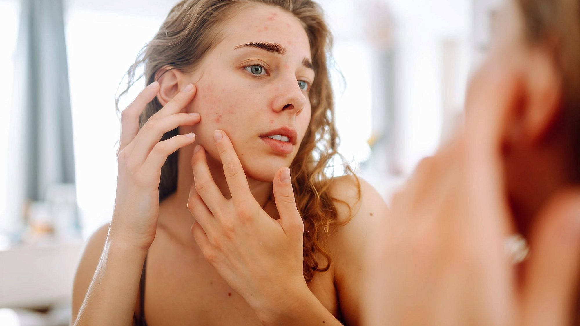 העור מתחרפן? מדריך לטיפול בעור רגיש | צילום: GettyImages