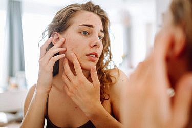 העור מתחרפן? מדריך לטיפול בעור רגיש | צילום: GettyImages