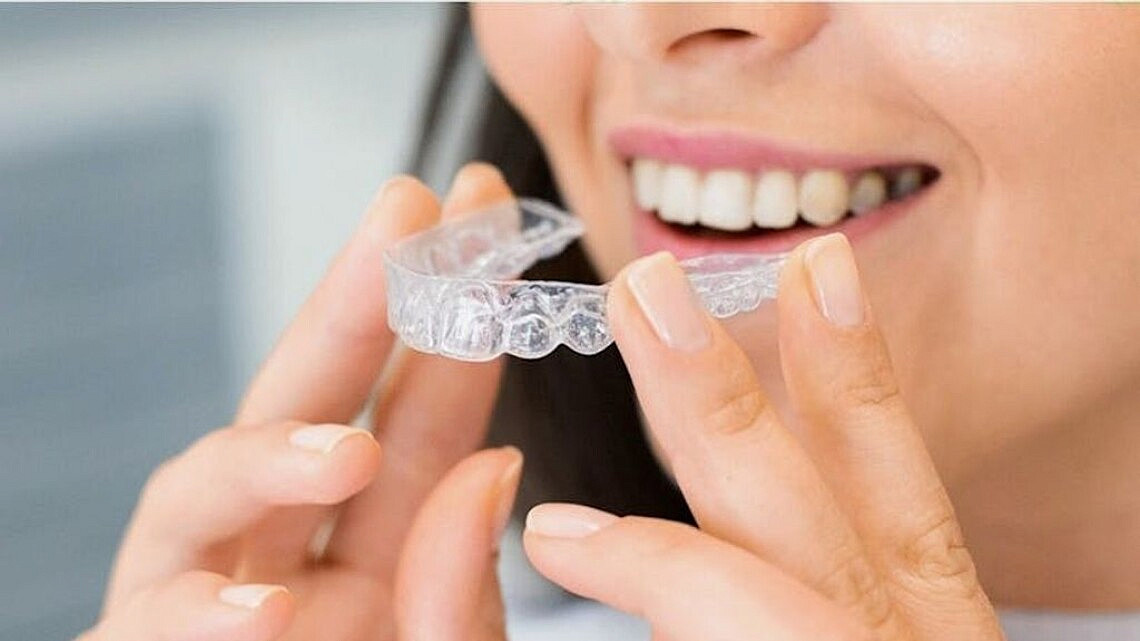 יישור שיניים לנשים. צילום: Arvind Philomin באתר PEXELS