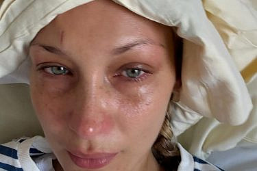 בלה חדיד | צילום: אינסטגרם bellahadid@