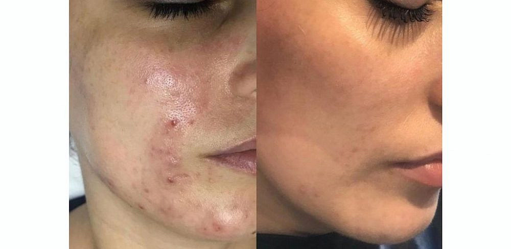 צילום: יפית רם