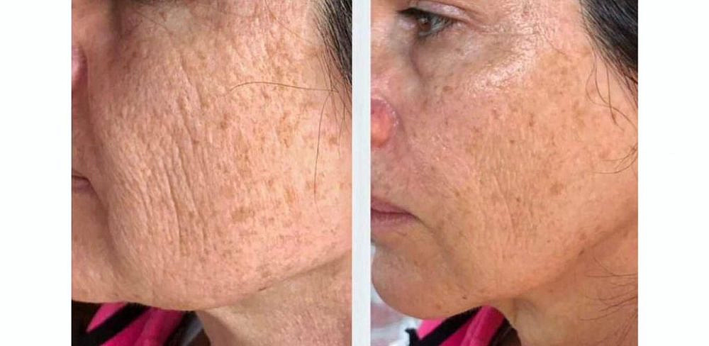 צילום: יפית רם