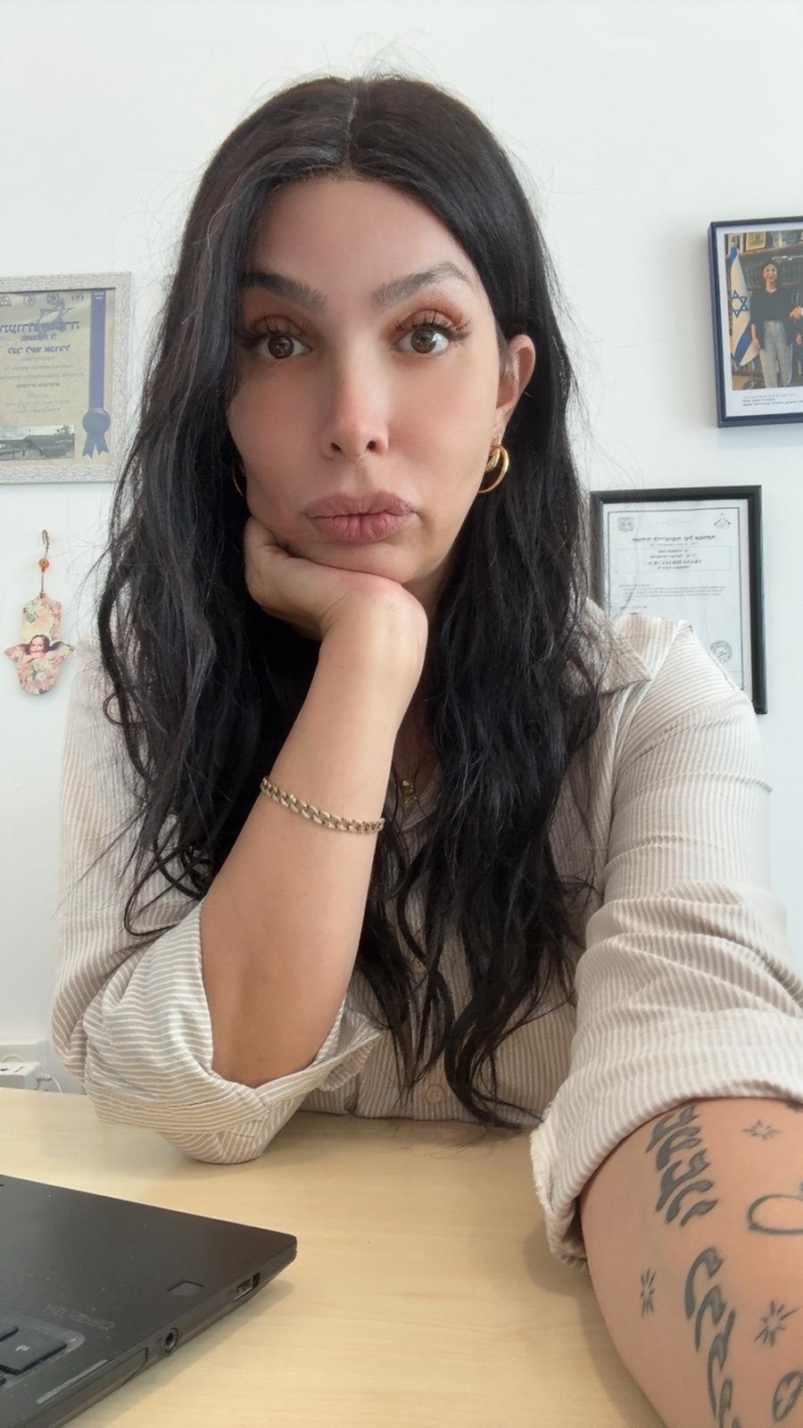 &quot;הניתוחים שעברתי זה בסוף קוסמטיקה&quot;. לינור אברג'ל | צילום: באדיבות המצולמת