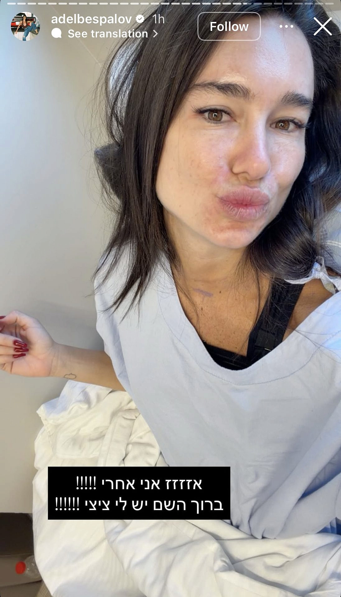 אדל בספלוב עברה ניתוח הגדלת חזה | צילום: אינסטגרם adelbespalov@