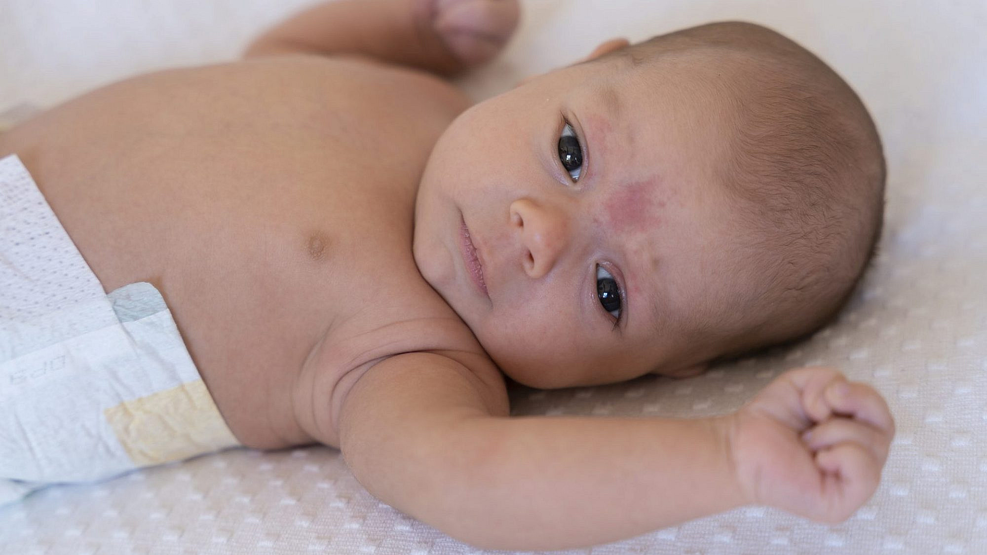 כל מה שצריך לדעת על חצבת | צילום אילוסטרציה: Freepik