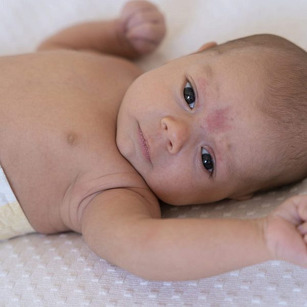 כל מה שצריך לדעת על חצבת | צילום אילוסטרציה: Freepik