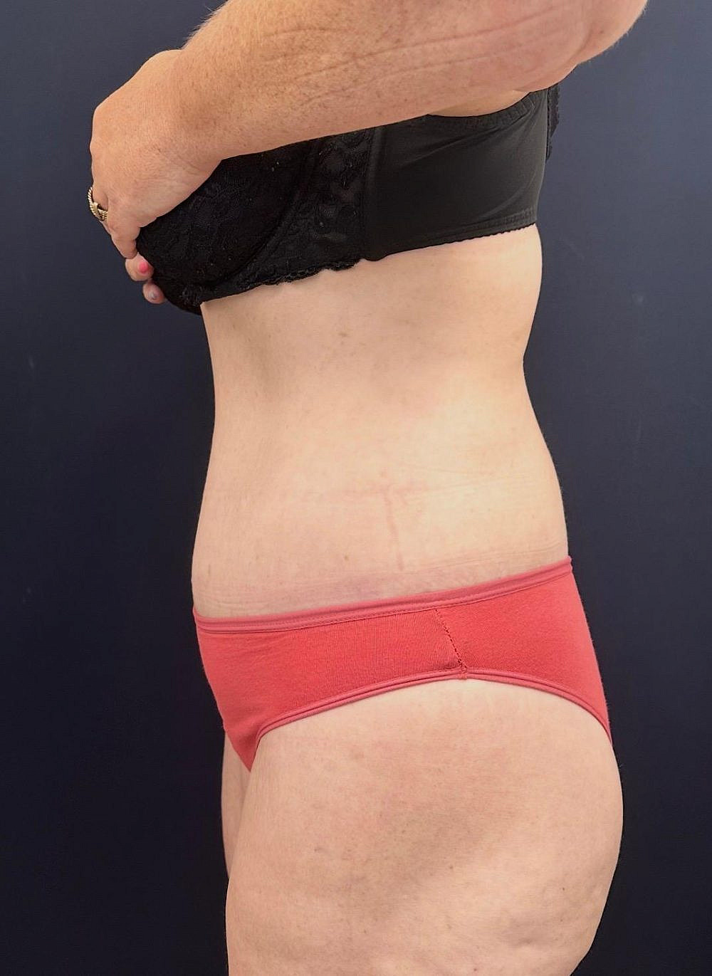 אחרי. צילום: יח"צ אחרי. צילום: יח"צ