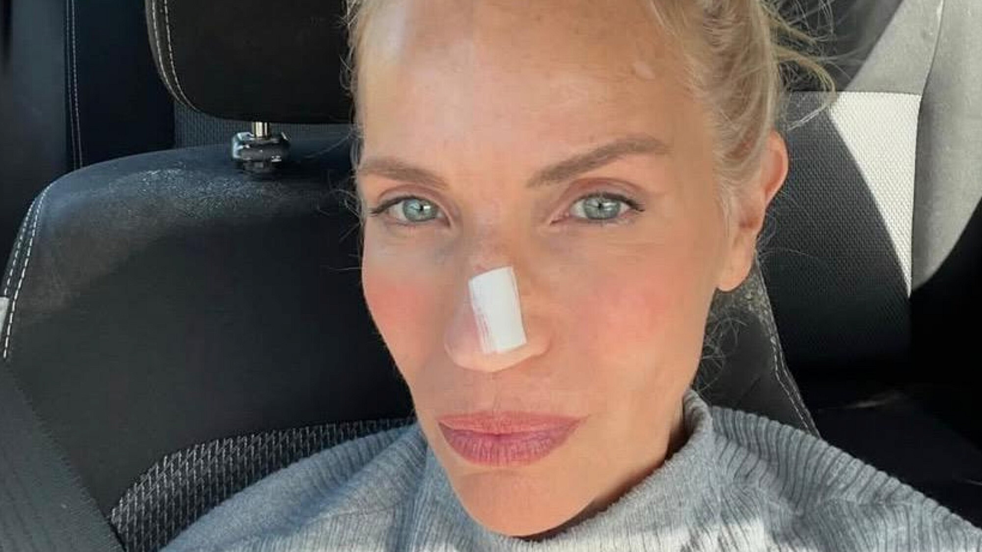 "נגע קטן על האף, כזה שאפשר היה להמשיך להתעלם ממנו". שרון פרי | צילום: אינסטגרם sharon_perry_30@