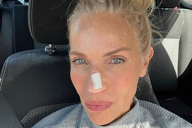 "נגע קטן על האף, כזה שאפשר היה להמשיך להתעלם ממנו". שרון פרי | צילום: אינסטגרם sharon_perry_30@