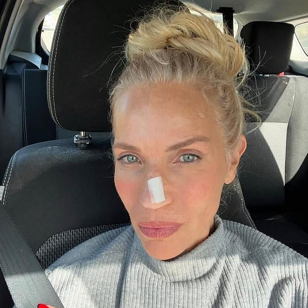 "נגע קטן על האף, כזה שאפשר היה להמשיך להתעלם ממנו". שרון פרי | צילום: אינסטגרם sharon_perry_30@