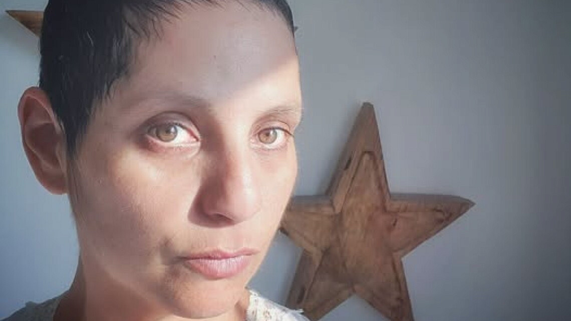 "מעולם לא היה שום דבר ורוד באוקטובר". ליאת ורדי בר בסלפי מהשנה הקשה בחייה | צילום: באדיבות המצולמת "מעולם לא היה שום דבר ורוד באוקטובר". ליאת ורדי בר בסלפי מהשנה הקשה בחייה | צילום: באדיבות המצולמת
