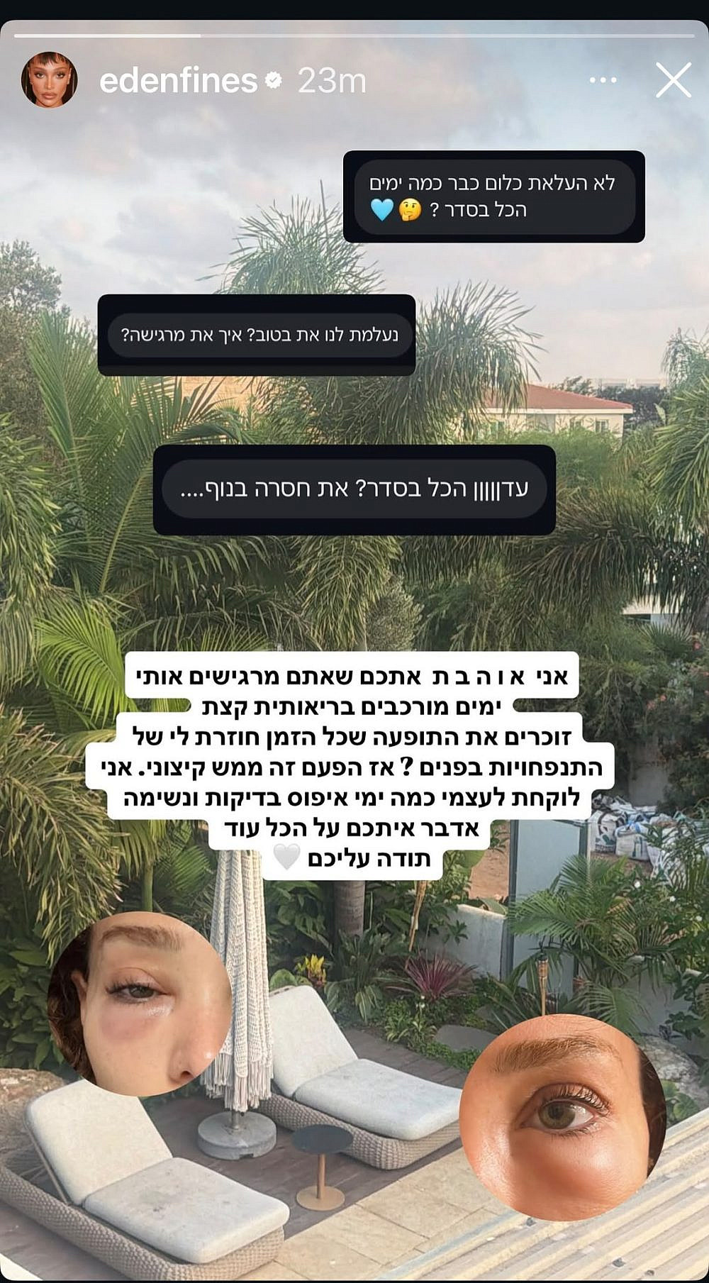 עדן פינס מעדכנת במצבה הבריאותי | צילום: אינסטגרם edenfines@
